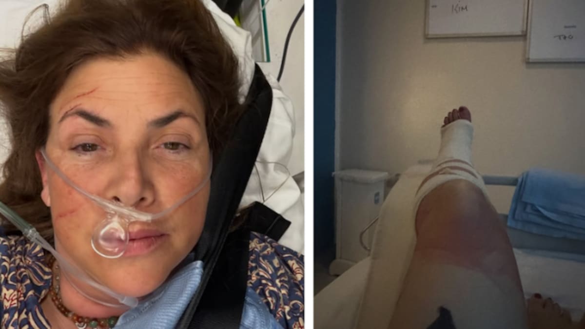 UK TV presenter Kirstie Allsopp rushed to hospital after fall during family holiday