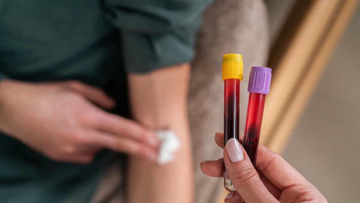 Routine blood testing may hold hidden clues to colorectal cancer