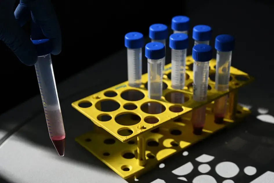 UAE approves drug that helps control production of excess red blood cells