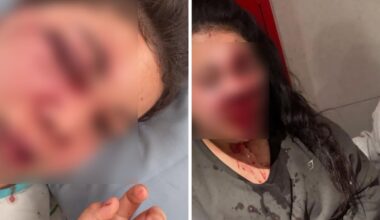 Auckland gym assault: Victim thanks bystanders who came to aid after suffering serious injuries