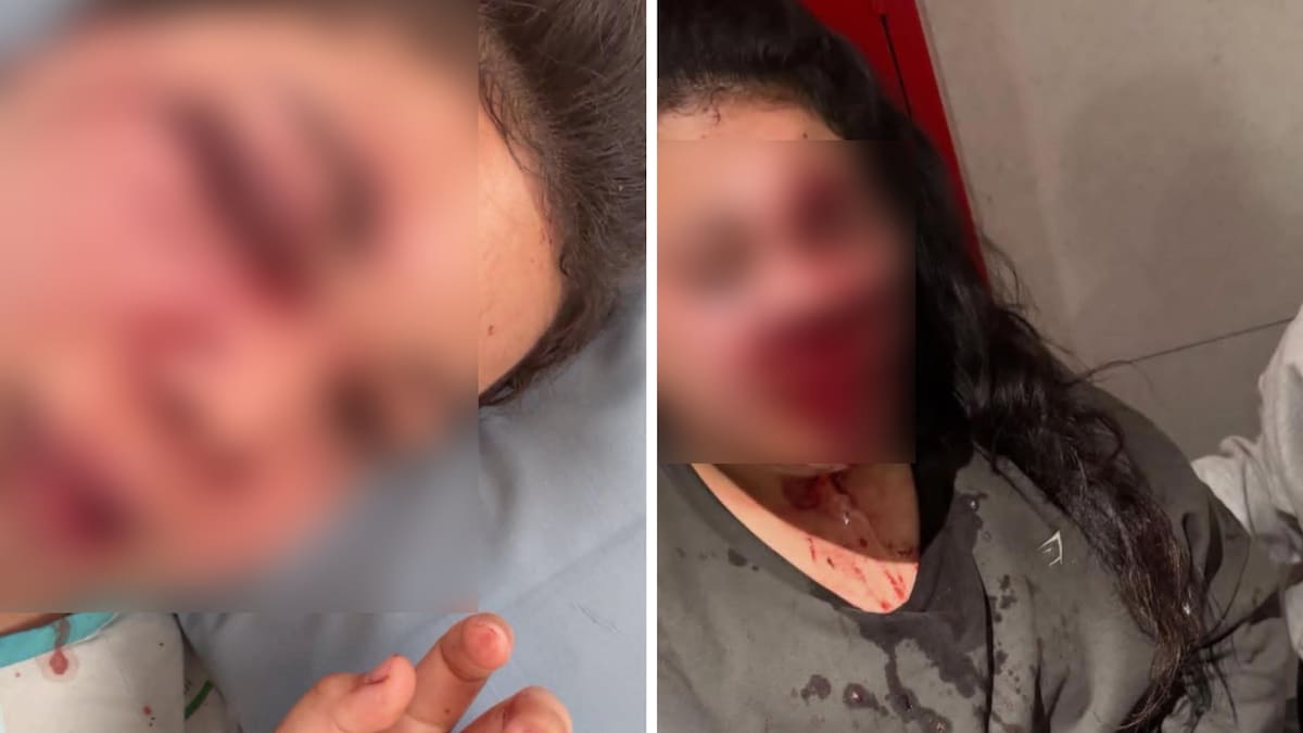 Auckland gym assault: Victim thanks bystanders who came to aid after suffering serious injuries