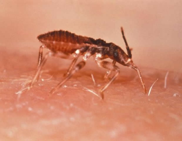 A 30-day benznidazole regimen offers safer Chagas disease treatment option