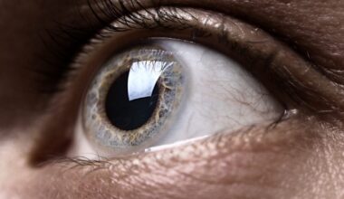 Atrial fibrillation: Eye scan may predict risk 4 years sooner