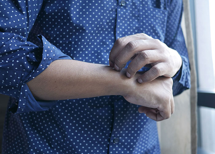 A man scratching his arm, showing symptoms of skin irritation. Doctors might stare at unusual symptoms like this.