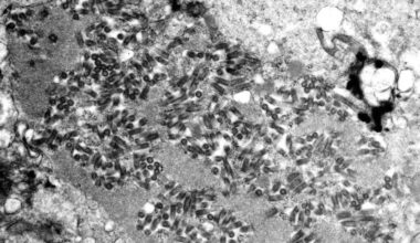 Human rabies exposure cases on the rise, CDC warns