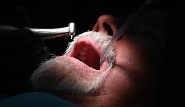 The oral condition that could increase dementia risk by over 50 per cent