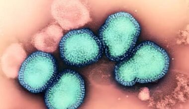 Is this really the worst flu season ever?