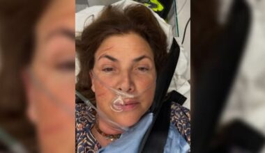 Love It or List It host Kirstie Allsopp in hospital after holiday mishap