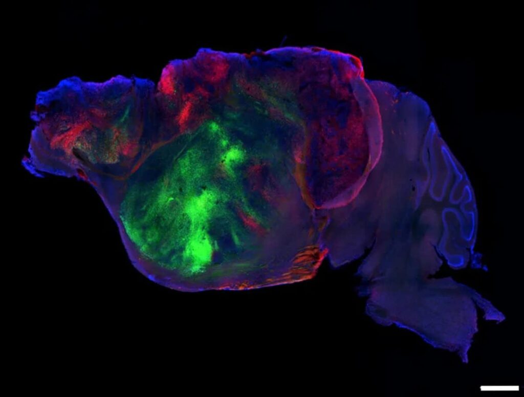 Side view of a mouse brain showing nerve fibers from the human graft, labeled in green and red