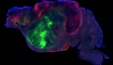 Scientists Grew Human Brain Tissue Inside Mice and It Actually Worked