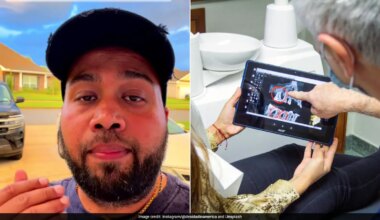 Watch: Man Shocked By Rs 2.37 Lakh Dental Bill In US, Compares Cost With India