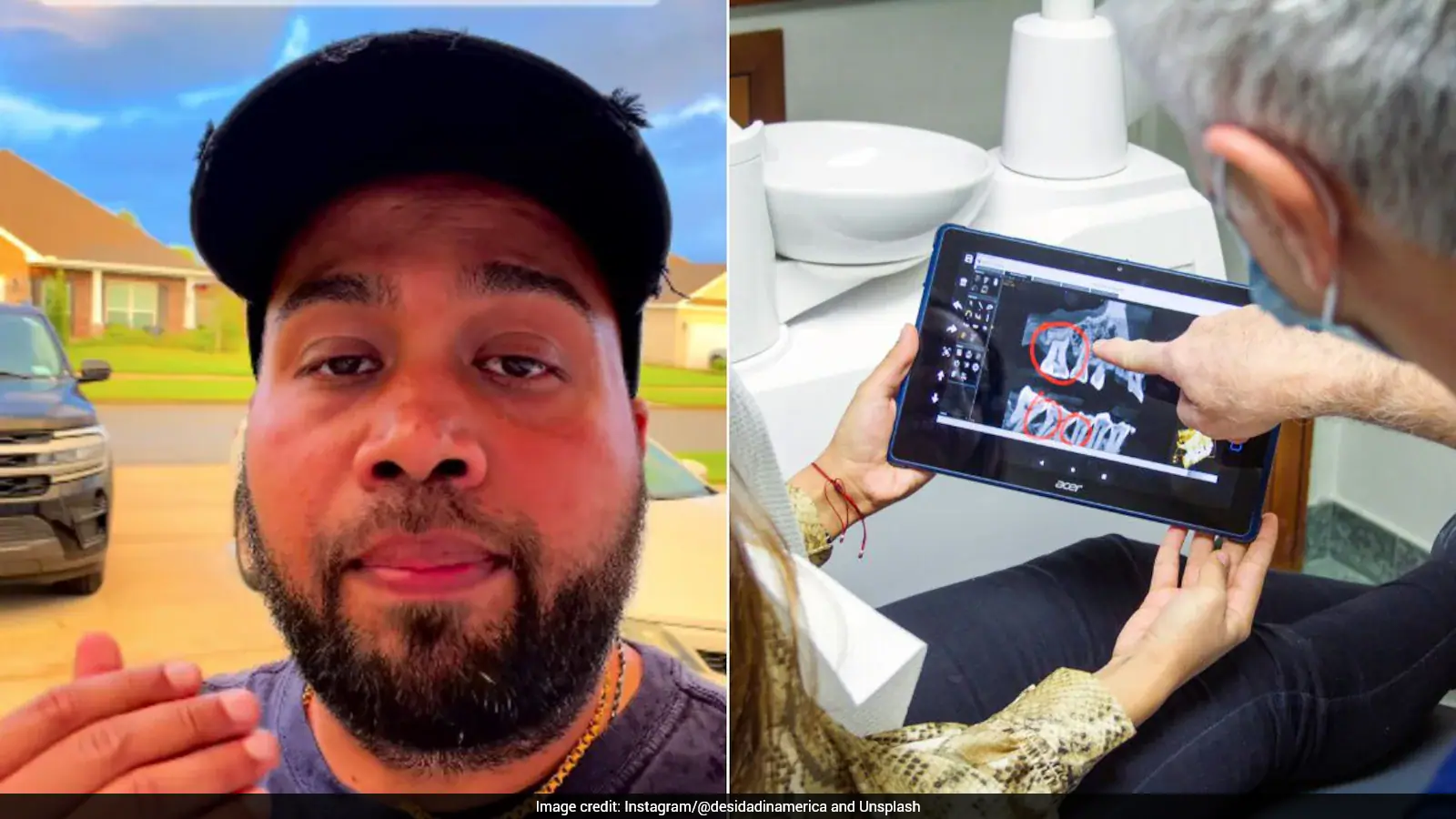 Watch: Man Shocked By Rs 2.37 Lakh Dental Bill In US, Compares Cost With India
