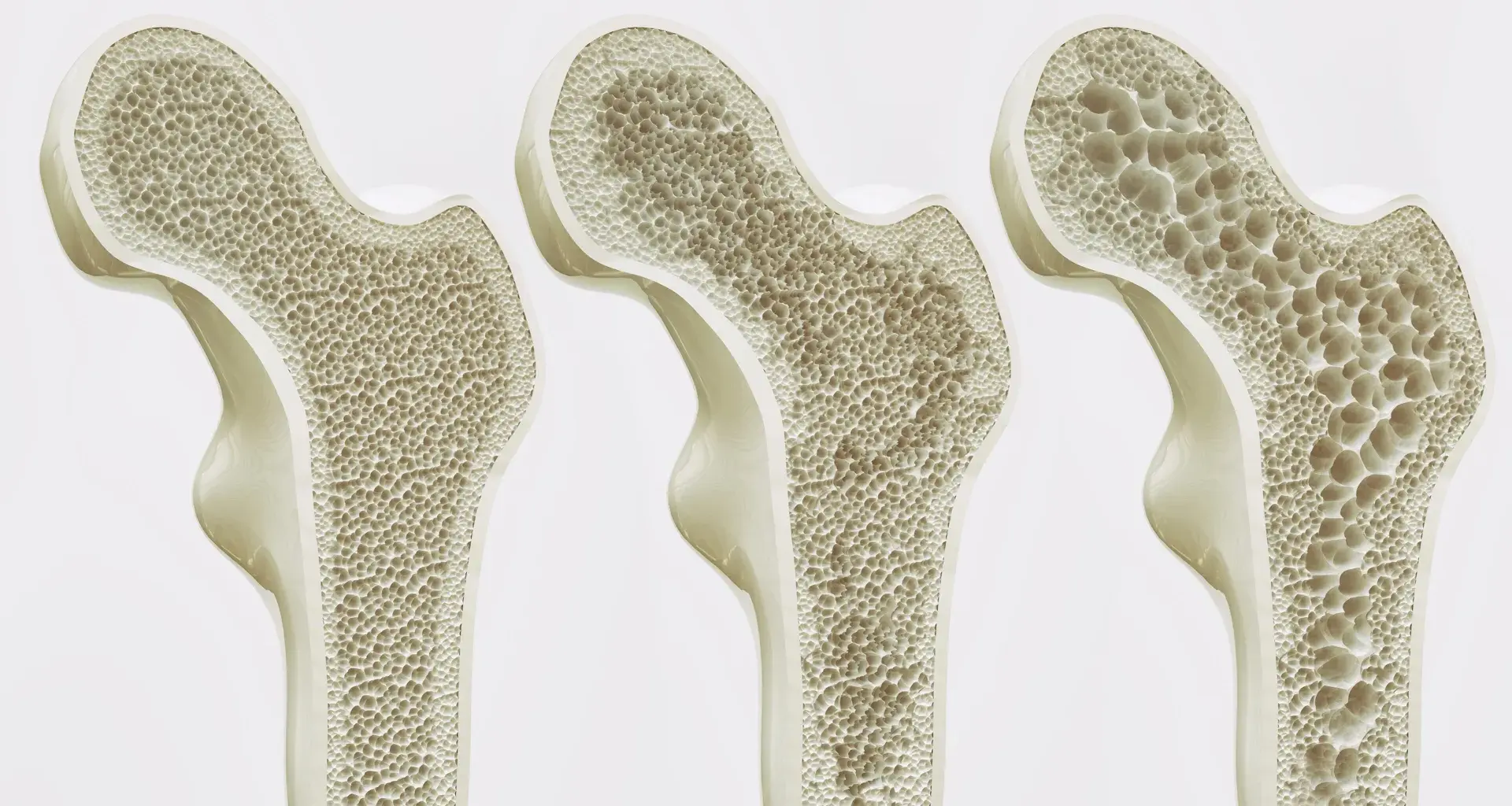 Too much coffee may weaken bones, study finds