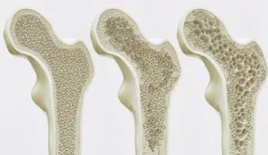 Too much coffee may weaken bones, study finds
