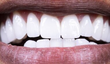Here's what to eat to protect your mouth's good bacteria