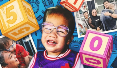 Mum of son with rare albinism dreams of what he can do, not what he can’t