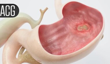 Enzyme Supplement May Ease IBS Symptom Severity