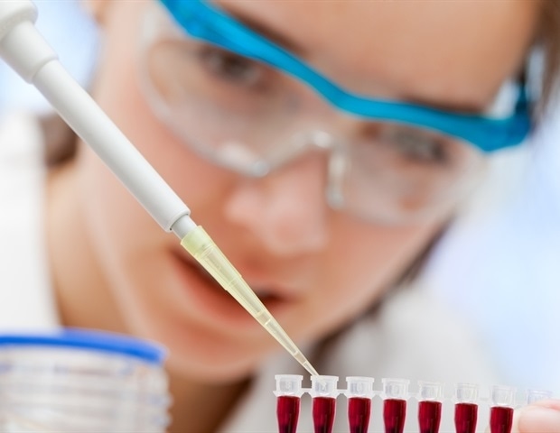 Blood proteins may offer new clues to gut health in coeliac disease