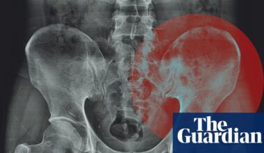 Do we really ‘hold tension’ in our hips? | Well actually