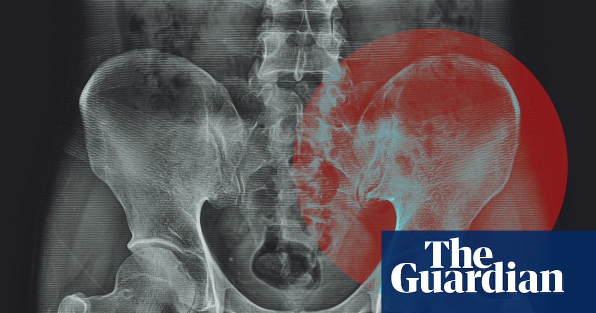 Do we really ‘hold tension’ in our hips? | Well actually