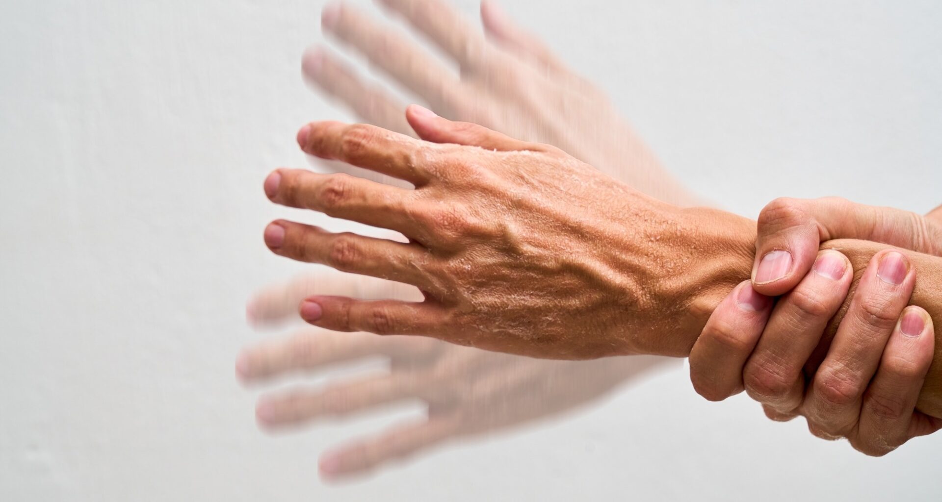 Study: Nicotinamide Riboside for Patients With Early-Stage Parkinson Disease. Image Credit: Fabian Montano Hernandez / Shutterstock