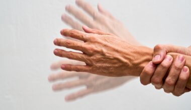 Study: Nicotinamide Riboside for Patients With Early-Stage Parkinson Disease. Image Credit: Fabian Montano Hernandez / Shutterstock