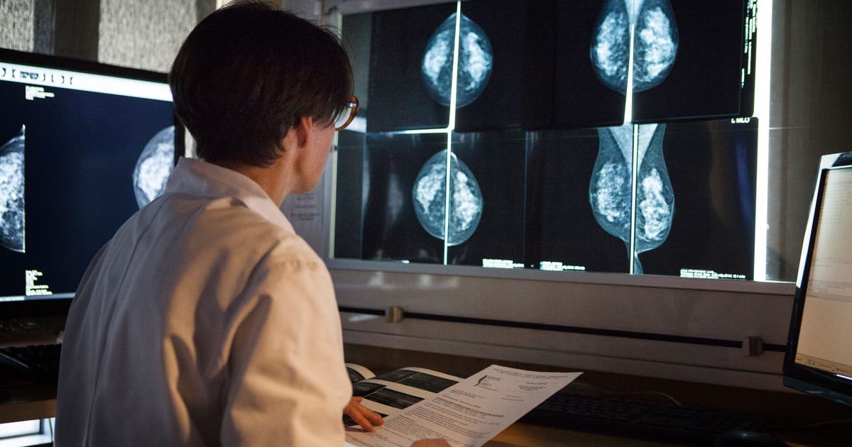 FDA clears use of AI tool designed to predict whether breast cancer will recur
