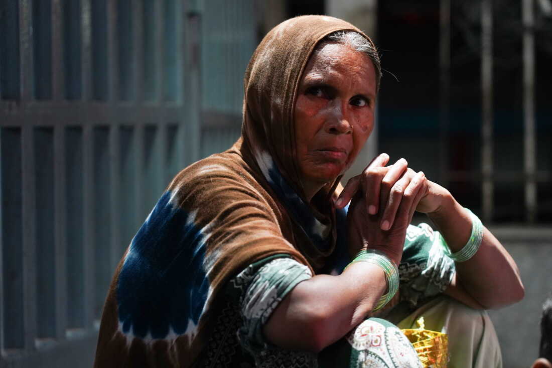 Suhana Bano, 47, from Bareilly, Uttar Pradesh, has been bringing her 18-year-old son, Mohammad Sameer, to Delhi for medical treatment for about two years. Bano has been staying on the pavement for the past month while waiting for her son’s next appointment at the hospital.