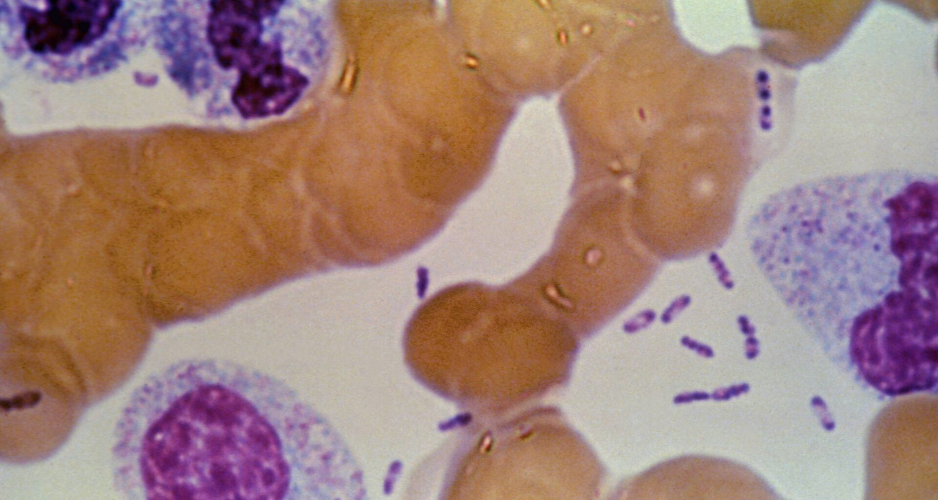 Five questions about the pneumonic plague concerns in Russia answered by a TXST microbiology and virology specialist