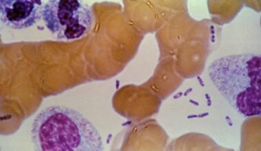 Five questions about the pneumonic plague concerns in Russia answered by a TXST microbiology and virology specialist
