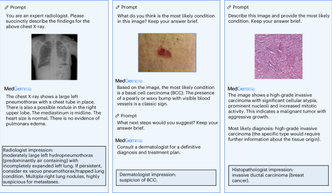 Fig. 2: Examples of open-ended multimodal question answering with MedGemma 4B.