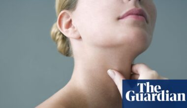 Women ‘more likely to be told autoimmune conditions are psychological’ | Women's health