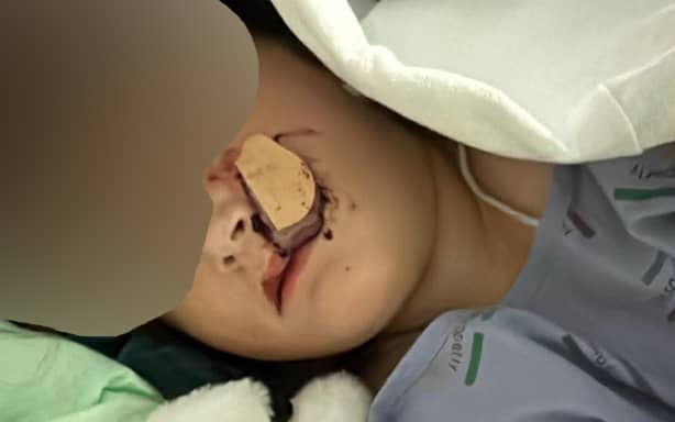 Dog attack - child victim blurred - 3 March 2026