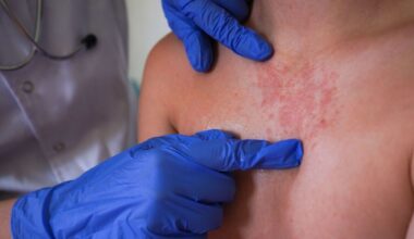 Horror Victorian disease outbreak forces closure of hospital ward - spreads quickly | UK | News