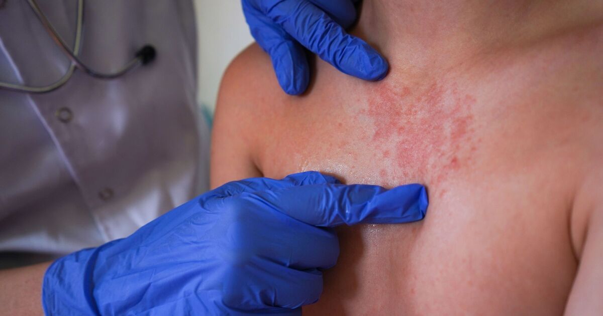 Horror Victorian disease outbreak forces closure of hospital ward - spreads quickly | UK | News