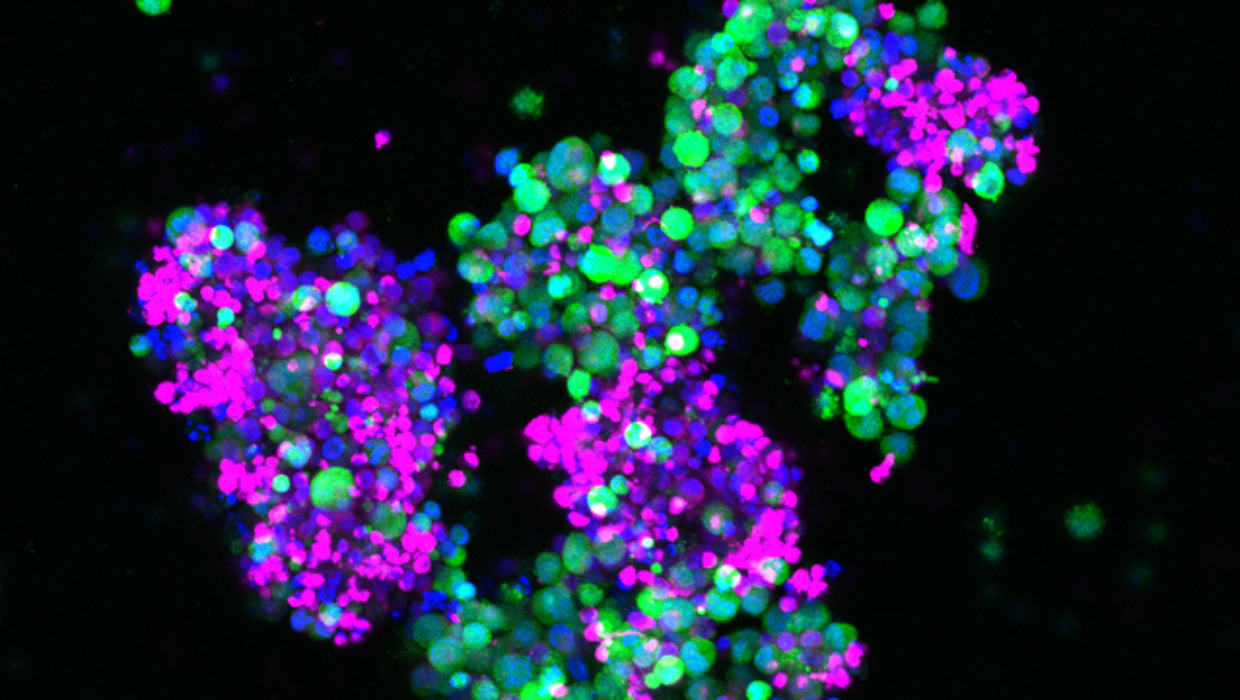 The $25m promise that could change cancer treatment in New Zealand - Stuff