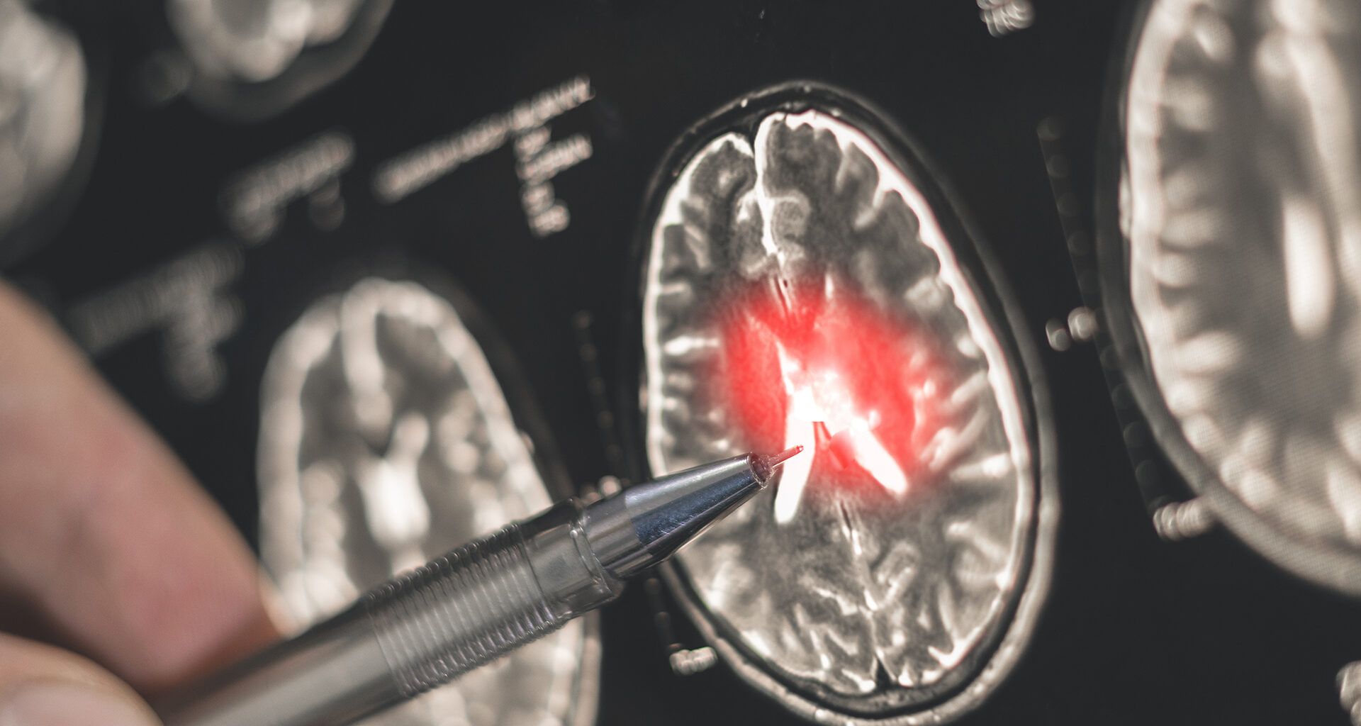 £80 million challenge launched to speed up dementia diagnosis