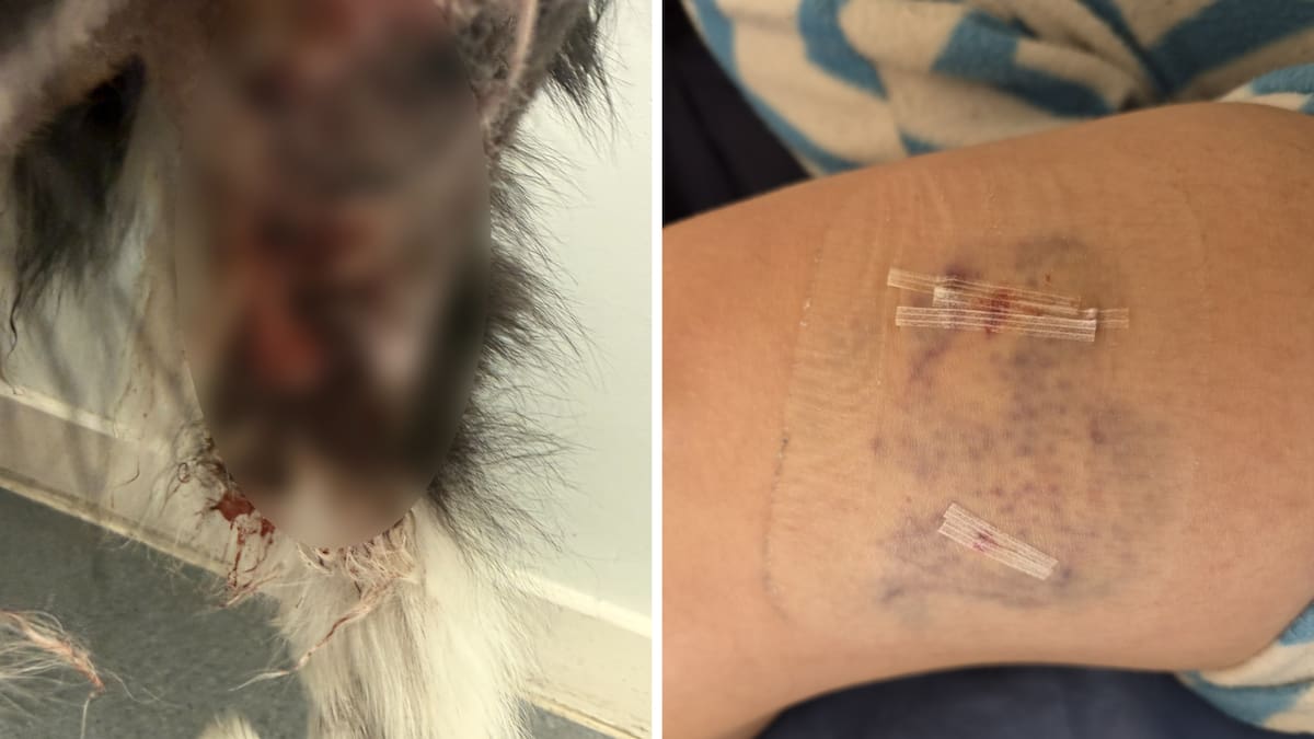 Christchurch dog attack: Council told owner it cannot force payment for costs