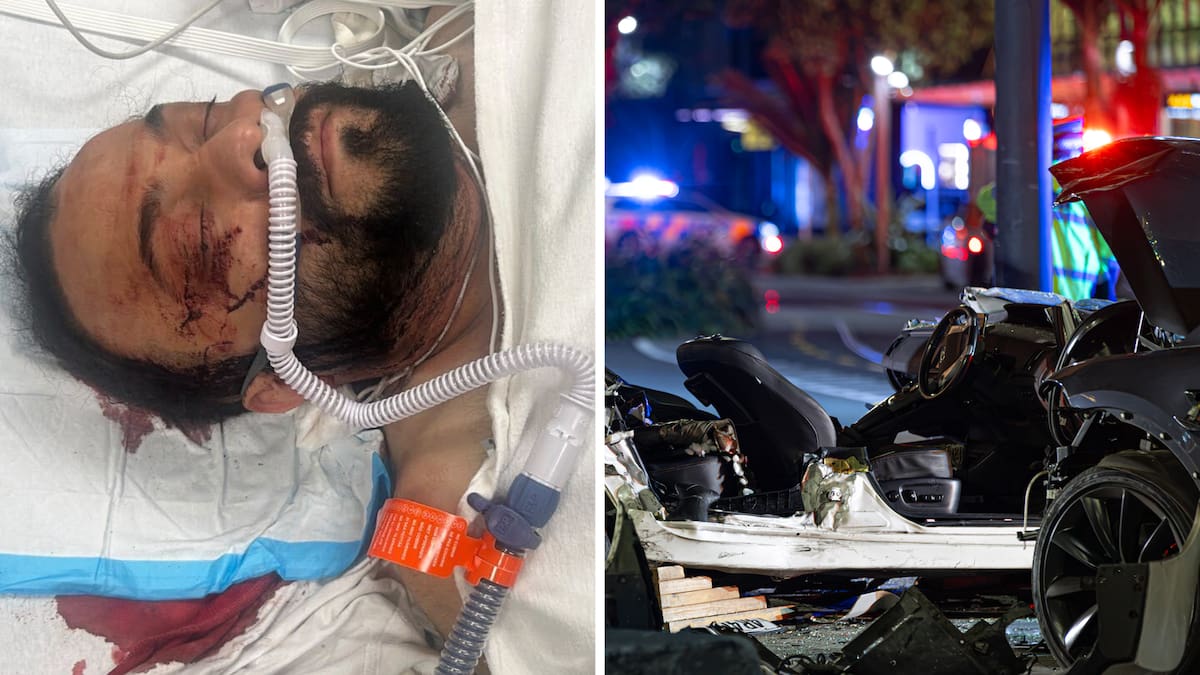 Cliff Curtis crash: Taxi driver Gagan Deep Singh faces long recovery from injuries