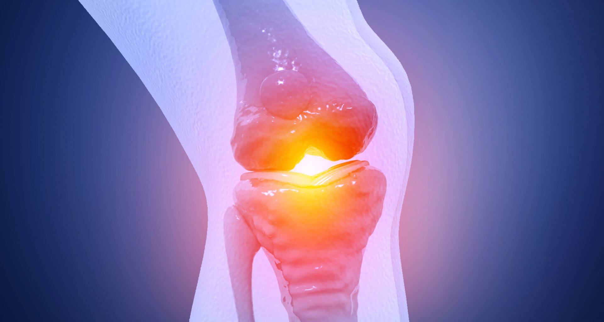 FDA-Approved Drug Could Be Repurposed to Relieve Osteoarthritis Pain And Protect Cartilage : ScienceAlert