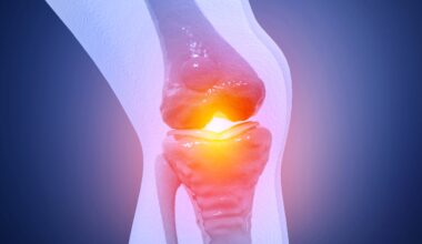FDA-Approved Drug Could Be Repurposed to Relieve Osteoarthritis Pain And Protect Cartilage : ScienceAlert