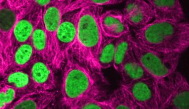 Human cells with fluorescently labeled chromatin (green) and microtubules (magenta) appear elongated after 24-hour exposure to fluid flows. Credit: Kanellakopoulos/Zidovska/NYU