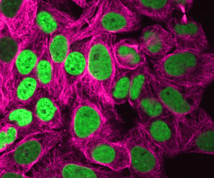Human cells with fluorescently labeled chromatin (green) and microtubules (magenta) appear elongated after 24-hour exposure to fluid flows. Credit: Kanellakopoulos/Zidovska/NYU