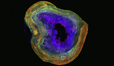 Human brain organoids come of age—but still have room to grow