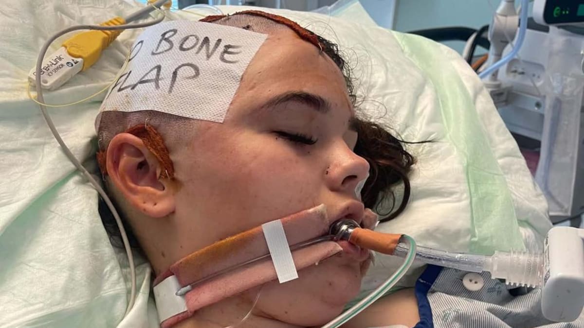 Manawatū teen Chloe fighting for life after falling from ute on Hīmatangi Beach