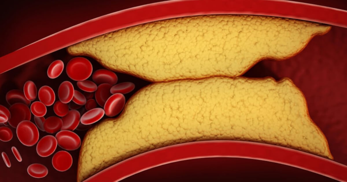 Catching up with metabolic health supplement science