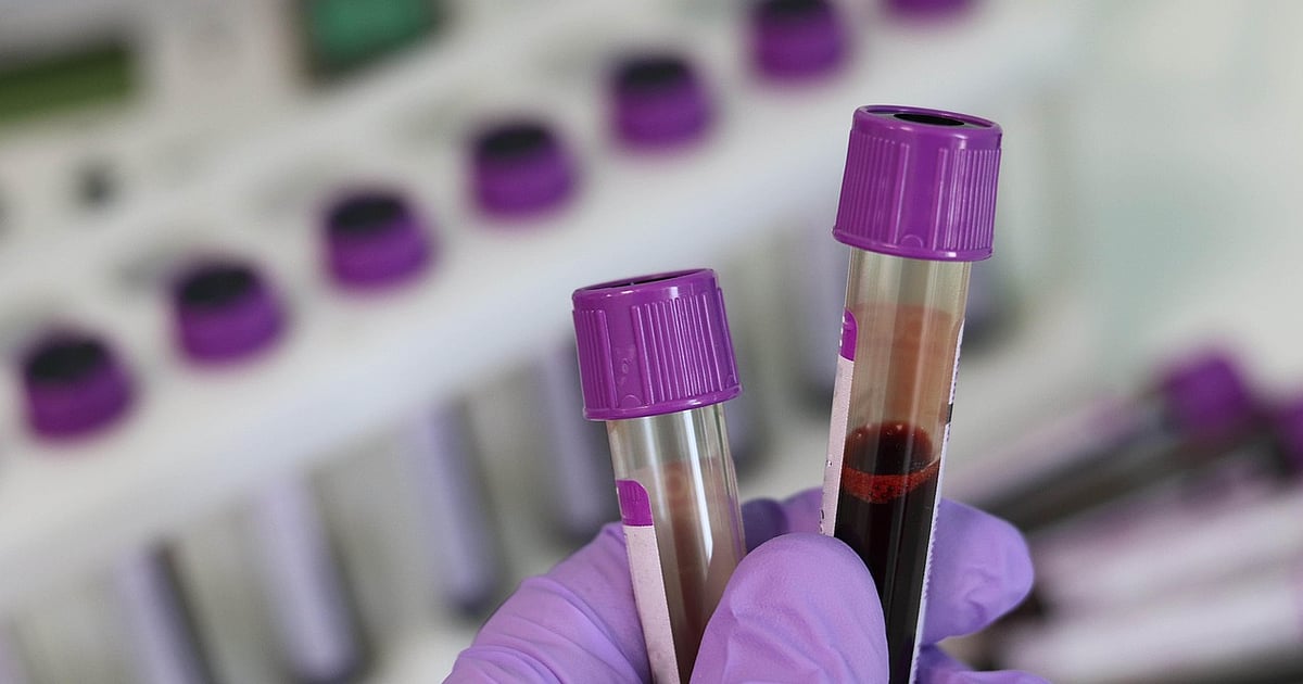 UAE Approves MIMRYLO (Rusfertide) for Polycythemia Vera, Expanding Treatment Options for Rare Blood Disorder and Blood Clot Risk