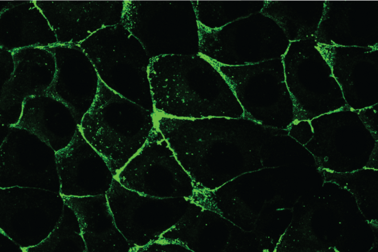 Finding Their Sense of Direction: Cell Movement Helps Tissues Establish Polarity