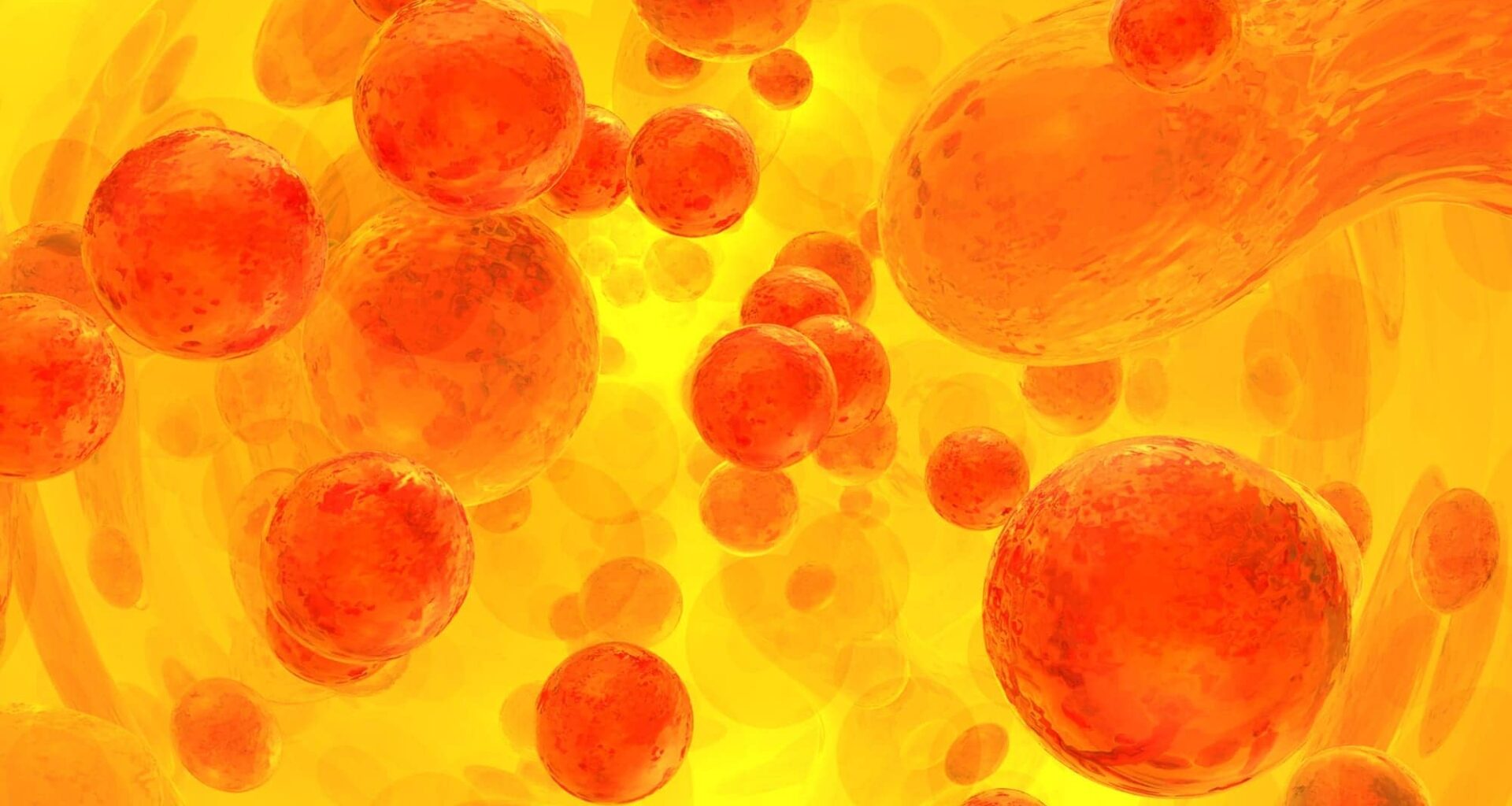 Severe Pneumonia May Signal Undiagnosed Blood Cancer
