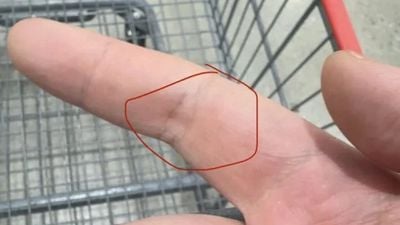 lowest index finger segment 